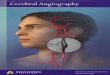 Diagnostic Cerebral Angiography - Johns Hopkins …...Diagnostic cerebral angiography is very safe when performed by a dedicated and experienced team such as ours. However, complications