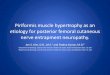 Piriformis muscle hypertrophy as an etiology for posterior ... ... Piriformis muscle hypertrophy as
