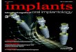 implants - ZWP online · dental implants are performed. The magic word is dual cooling – instrument cooling from the inside and outside together with simultane-ous debris evacuation
