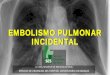 EMBOLISMO PULMONAR INCIDENTAL€¦ · pulmonary embolism. J Thromb Haemost 2012; 10: 496–498 •Tamaño y localización de los coágulos Den Exter PL, Kroft LJ, van der Hulle T,