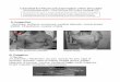 Checklist for Physical Examination of the Shoulderunmfm.pbworks.com/w/file/fetch/112906198/Shoulder... · Drop Arm Test F. Referred Shoulder Pain Cervical Spine (disc disease) Myofascial