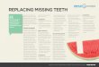 REpLAcIng mIssIng TEETH - Dental Concepts · 2019-12-19 · REpLAcIng mIssIng TEETH Replacing missing teeth can sometimes appear a daunting prospect but we offer a variety of solutions