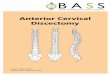 Anterior Cervical Discectomy - Complex Spine · 2019-02-02 · removed. Cervical fusion is then commonly carried out at the same time as cervical discectomy. To achieve a spinal fusion,