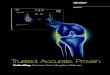 OrthoMap Precision Knee Navigation Software€¦ · Intuitive Software Solutions: The Reactive Workflow feature seamlessly maneuvers through kinematic and resection screens based