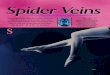 Spider Veins - Sclerotherapy | Manitowoc, Wisconsin veins.pdf · 2012-05-03 · disorders, spider veins are due to leaky one-way check valves located within the veins. These leaky