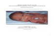 Baptist Health South Florida Neonatal Moderate …content.baptisthealth.net/healthstream/Neonatal_Mod_Sed...Deep sedation is a drug-induced depression of consciousness during which