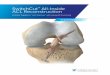 SwitchCut All-Inside ACL Reconstruction€¦ · the intra-articular entrance, slide the O-ring to the back of the bullet (Figure 8a). Figure 7 Figure 8 Figure 8a. 5 | SwitchCut All-Inside