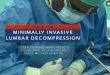 WHY & HOW MINIMALLY INVASIVE LUMBAR DECOMPRESSION · • What is Minimally invasive spine surgery? ... 2.RETRACTORS self retaining table mounted blades / hooks tubular OPEN DECOMPRESSION