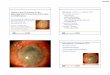 Options and Outcomes in the Management of Corneal Limbal ... · Limbalgraft and/or amniotic membrane transplantation in the treatment of ocular burns. Ophthalmologica. 2005;219:297-302