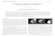 Ultrasound as a secondary screening tool in ... · with mammographically dense breasts because of the radio- ... theearlydetectionofbreastcancerwiththeaimofreducingthe ... breastimaging,especiallyinwomenwithdensebreastsandthatultrasoundcanhaveabenefitasasecondaryscreening