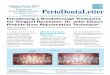 “Excellence in Non-Surgical Periodontics, Implants & Laser … · 2014. 7. 28. · Pinhole Gum Rejuvenation offers patients an alternative to connective tissue graft surgery to
