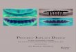 PROCERA IMPLANT BRIDGE - dr-noelken.de IMPLANT... · 2017. 7. 24. · 2 Dent Implantol 6, 341-356(2002) Introduction of the Procera ® Implant Bridge Concept Dr. Robert Noelken 2002