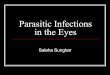 Parasitic Infections in the Eyesstaff.ui.ac.id/system/files/users/saleha.sungkar/... · Ocular Larva Migrans The organism induces an inflammatory reaction – if macula/optic nerve