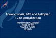Adenomyosis, PCS and Fallopian Tube Embolization€¦ · Adenomyosis 511 women 15 studies/76% improvement F/U 26/12 29 women (15 with fibroids) 82% Hsterctomy avoided, 72% satisfied