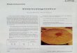 Dipòsit Digital de Documents de la UAB · (5-10 días): Ojos visibles Forma de pollo Falta de plumas Enfriamiento durante la transferencia Deficiente ventilación y oxigenación