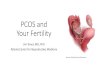 PCOS and Your Fertility - PCOS ChallengePCOS and Your Fertility Jim Toner, MD, PhD Atlanta Center for Reproductive Medicine PCOS Consequences • Androgen excess • Acne, oily skin
