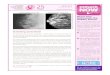 Please Give Generously Thislaura-elman.com/uploads/CBCF_Winter2011_Newsletter_v11.pdf · With $13.8 Million raised in Ontario alone, this year’s Canadian Breast Cancer Foundation