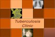 Tuberculosis Clinic · 2019. 3. 9. · Tuberculosis Clinic Location 5115 El Paso Drive, Suite B, Door 3 El Paso, Texas 79905 Telephone (915) 212-0200 option 4 Or direct (915) 212-6609