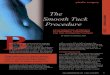 The Smooth Tuck plastic surgery Procedure - Plastic Surgeon and Cosmetic Surgery New ... · 2020. 7. 13. · aggressive liposuction of the abdomen, followed by excess skin “I want