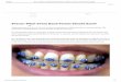 Braces: What Every Band Parent Should Know · 2019. 10. 15. · Should Know” 2 5 1 Rebecca Schmorr Great tips! I am a dentist in Raleigh providing braces as well as Invisalign and