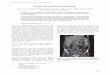 Postpartum Ovarian Vein Thrombosis · Bahrain Medical Bulletin, Vol. 38, No. 3, September 2016 173 OVT is a rare but potentially serious complication which is most often diagnosed