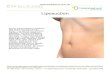 Liposuction - Dr Ellis Choy · Are you considering liposuction? Almost any area of your body can be contoured with liposuction – thighs, hips, buttocks, lower legs, back, abdomen,