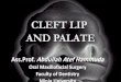 CLEFT LIP AND PALATE y... · 2020. 3. 19. · •Combined cleft lip and palate = 50 % > isolated cleft palate (30%), > isolated cleft lip or cleft lip and alveolus (20%). •the risk