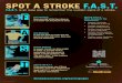 SPOT A STROKE F.A.S.T. · 2018. 11. 7. · SPOT A STROKE F.A.S.T. FACE DROOPI AR WEAKESS SPEEC DIFFICT TIE TO CA 911 Face Drooping Does one side of the face droop or is it numb? Ask