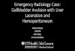 Emergency Radiology Case: Gallbladder Avulsion with Liver ... · • Standard order of evaluation is usually: • Pericardial • Hepatorenal (right flank) ... Axial CT Abdomen Venous