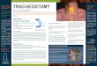 TRACHEOSTOMY leaflet.pdf · Tracheostomy is a procedure to create an opening through the neck into the trachea (windpipe). After the opening is created, a tracheostomy tube will be