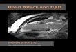 Heart Attack and CAD - Houston MDs Handouts/Heart Attack and CAD... · the heart hurts, the mind knows only that something is wrong, not what. The sensation arises when heart muscle