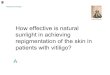 How effective is natural sunlight in achieving repigmentation of … · • Does diet have an effect on vitiligo and or treatments • Can dietary changes help avoid/reduce/treat