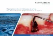 Treatment Concepts - Artis · Suggested treatment concept for periodontally compromised teeth 5 ... in treating periodontal disease has gained in significance and is now an integral