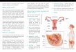 What is ovarian cancer? What are the risk factors ...shaukatkhanum.org.pk/.../2016/10/Medical-Oncology-Ovarian-Cancer.… · Ovarian cancer is known as a silent killer, as most women