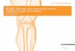 KNEE Single-Bundle ACL Reconstruction: Medial Portal …...ACL femoral attachment site to be viewed through the AM portal, while working instrumentation is inserted into the notch