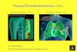Thrombophilia & cardiovascular Deep Vein Thrombosis ¢â‚¬â€œ DVT . Pulmonary Embolism PE ¢â‚¬â€œ Dr. Mudi Misgav