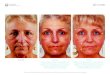 BEFORE AFTER AFTERCorrector, and ageLOC Galvanic Spa and Facial Gels twice per week)) * Please note the lighting difference from the Before to the After photos may make these changes