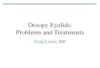 Droopy Eyelids: Problems and Treatments...Eyelid Ptosis •Potential serious causes: –Muscle disorders •Myasthenia Gravis, Lambert-Eaton Syndrome –Nerve disorders •Multiple