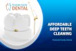 Affordable deep teeth cleaning Modesto | Dentist Modesto
