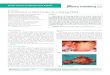 Leiomyoma of Oral Cavity in a Young Child · Citation: Subramanya Sharma S, Ramakrishnan K, Vijayalakshmi D and Saravanan C. Leiomyoma of Oral Cavity in a Young Child. Austin J Clin