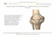 Synovial Problems – Removal Of Painful Plica€¦ · Removal of Painful Plica Introduction The synovial membrane is found in joints like your knee and shoulder. This thin membrane
