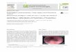 Esophageal melanocytosis: Case report and literature revie · Esophageal melanocytosis is a rare benign entity, with lit-tle speciﬁcity in terms of symptoms, usually located in