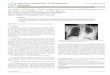 Journal of Pulmonary & Respiratory - 104 43 P ¢ 0-3061.100,04 … · 2018. 6. 9. · V 4 3 0163 100,04 - 104 43o ¢ 0-3061.100,04-0163 Case Report Open Access Coexistent Pulmonary