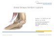 distal biceps tendon ruptur - luot.chluot.ch/.../2017/09/distal-biceps-tendon-ruptur.pdf · distal biceps tendon rupture - Inzidenz 1,2/100000 pro Jahr - Männer zw. 40-50j - conservative