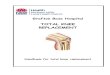 TOTAL KNEE REPLACEMENT - Dr Sam MartinThe Total Knee Replacement consists of 4 parts; The upper femoral component replaces the weight bearing surfaces of the femur (thigh bone) and