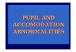 PUPIL AND ACCOMODATION ABNORMALITIES · Immediately after trauma, the pupil may be miotic, but changes to medium mydriasis early on, demonstrating a weak reaction to light. •The