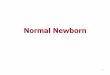 پزشکی خانواده - Home - Normal Newbornfamilymed.sbmu.ac.ir/uploads/Normal_Newborn_dr_gholami.pdf · 2017. 9. 27. · Cephalhematoma is a subperiosteal collection of blood