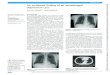 An incidental finding of an oesophageal duplication cyst...Aujayeb A, Narkhede P. M Case Rep 2019;12:e231753. doi:10.1136/bcr-2019-231753 1 An incidental finding of an oesophageal