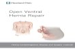 Open Ventral Hernia Repair - Cleveland Clinic...Open ventral hernia repair Anatomy of the abdominal wall It is important to know some basic anatomy of the abdominal wall before describing