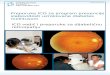 International Council of Ophthalmology · Web view•Broj oboljelih od diabetes mellitusa (broj stanovnika x prevalenca DM prema IDF podacima) h. Broj pacijenata koji su primili laserski